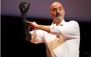 Nigel Ackland: Người đàn ông sở hữu 'cánh tay Terminator' ngoài đời thực