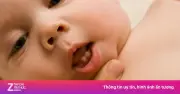Phân biệt sốt mọc răng và sốt thông thường ở trẻ