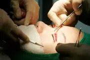 Phẫu thuật thẩm mỹ hỏng khiến người phụ nữ không thể nhắm mắt khi ngủ