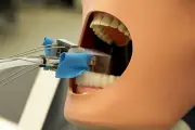 Robot nha khoa giúp bệnh nhân bọc răng sứ chỉ trong một lần hẹn