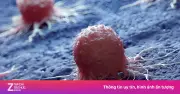 Số ca ung thư toàn cầu tăng 21%, thiếu hụt 100 triệu nhân viên y tế vào năm 2050