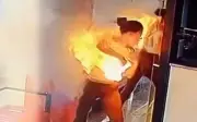 Sạc dự phòng phát nổ khiến nữ influencer Kazakhstan bị bỏng nặng
