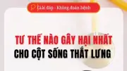 Tư thế nào gây áp lực nặng nhất cho vùng cột sống thắt lưng?