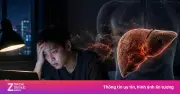 Thức khuya sau 23h: Thói quen âm thầm tàn phá lá gan của bạn