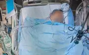 Thiếu kali gây tử vong: Bài học đau lòng từ người đàn ông 60 tuổi