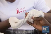 Tổng thư ký LHQ kêu gọi đẩy nhanh kết thúc đại dịch AIDS