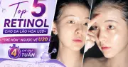 Top 5 kem retinol chống lão hóa tốt nhất hiện nay: Từ bình dân đến cao cấp