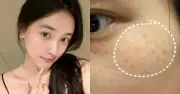 Top 7 kem mờ nám da bật tone trắng hồng, hiệu quả cả nám hỗn hợp