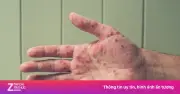 TP.HCM cảnh báo nguy cơ dịch chồng dịch khi mùa mưa đến