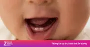 Trẻ mọc răng sữa đầu tiên khi nào? Dấu hiệu và cách chăm sóc