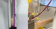 Uống 4 cốc trà sữa một ngày, người phụ nữ 39 tuổi máu trắng như sữa suýt mất mạng