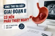Ung thư dạ dày giai đoạn II: Phẫu thuật là ưu tiên hàng đầu