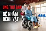 Ung thư gan âm thầm: Bác sĩ Bạch Mai chỉ dấu hiệu dễ nhầm bệnh vặt