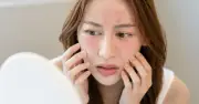 Vì sao da vẫn breakout vào hè dù chu trình skincare không đổi?