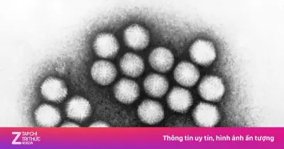 12 trẻ mắc Adenovirus nhập viện tại Phú Thọ, bác sĩ cảnh báo dấu hiệu nhận biết