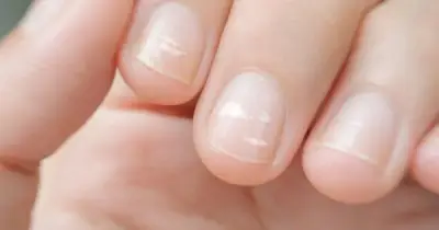 5 dấu hiệu trên bàn tay cảnh báo ung thư, bác sĩ khuyên đừng chủ quan