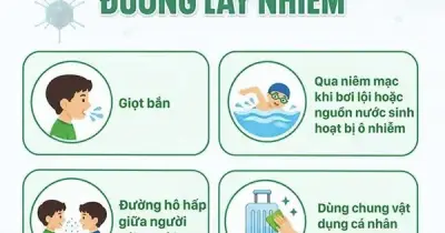 Bộ Y tế cảnh báo gia tăng ca bệnh virus Adeno ở trẻ em