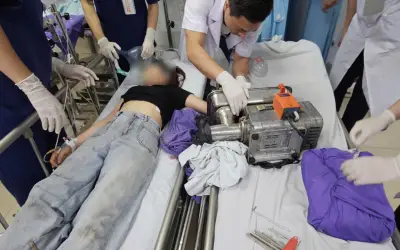 Bệnh viện Bãi Cháy cấp cứu nữ bệnh nhân 19 tuổi bị máy xay thịt cuốn nát bàn tay