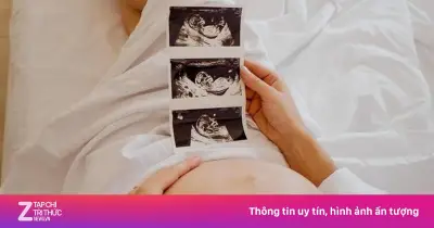 Chuẩn bị mang thai: Dinh dưỡng, lối sống và khám tiền thai giúp thai kỳ khỏe mạnh