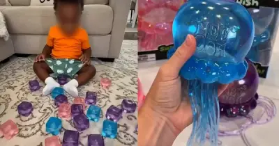 Cảnh báo đồ chơi NeeDoh: Trẻ bắt chước TikTok bị bỏng độ II, III