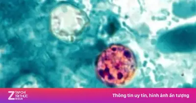 Gần 7.000 ca mắc bệnh đường ruột do ký sinh trùng tại 34 bang của Mỹ
