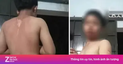 Đắk Lắk xác minh vụ bé trai nghi bị mẹ tạt nước sôi bỏng nặng