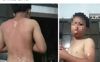 Mẹ tạt nước sôi vào con trai ở Đắk Lắk: Công an vào cuộc xác minh