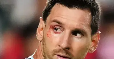 Messi rách mí mắt, Argentina thắng Thụy Sĩ 3-1 vào bán kết World Cup 2026