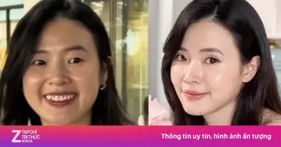 Midu mặt mộc gây tranh cãi: Sao Việt và quốc tế đối mặt áp lực ngoại hình