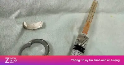 Nam thanh niên 25 tuổi nhập viện vì vòng kim loại siết chặt vùng kín