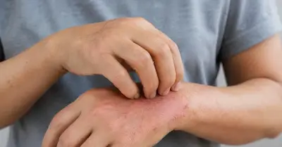 Ngứa ở 2 vị trí trên cơ thể có nguy cơ là dấu hiệu xơ gan
