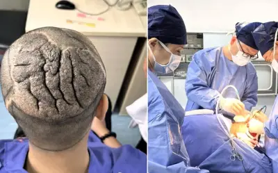 Người đàn ông Trung Quốc mắc bệnh lạ khiến da đầu nhăn như não