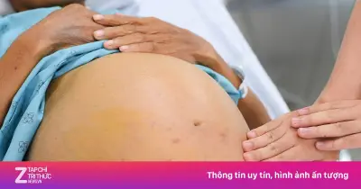 Người trẻ 20-30 tuổi trả giá đắt vì thói quen âm thầm gây kháng insulin
