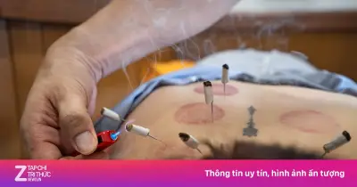 Người trẻ đổ xô đi châm cứu, xoa bóp vì đau cổ vai gáy