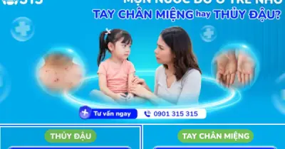 Phân biệt mụn nước và thủy đậu: Dấu hiệu, chăm sóc và vắc xin