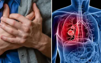 Phát hiện ung thư phổi giai đoạn sớm nhờ khám sức khỏe định cư