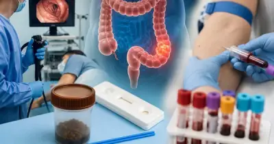 Từ 45 tuổi nên tầm soát ung thư đại trực tràng: Nội soi vẫn là 'tiêu chuẩn vàng'