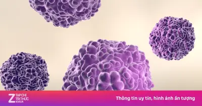 Tay chân miệng: Bệnh thường gặp ở trẻ, dễ chuyển nặng nếu chủ quan