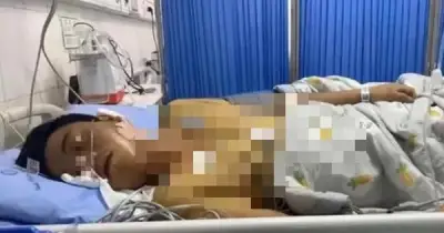 Ung thư gan cướp đi hơn 700.000 mạng mỗi năm, bác sĩ cảnh báo 5 dấu hiệu sớm