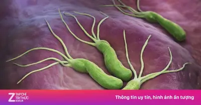 Vi khuẩn HP lây âm thầm qua nhiều thế hệ, gây ung thư dạ dày