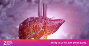 5 thói quen giúp gan tự giải độc và phục hồi tự nhiên