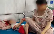 Bé 3 tuổi bị cha dượng bạo hành nhập viện, công an vào cuộc