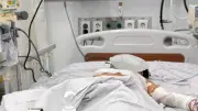 Bé trai 7 tuổi bỏng 50% cơ thể sau tai nạn xe khách tại Đồng Nai