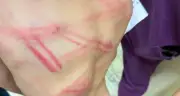 Bé trai 9 tuổi bị bố đánh nhập viện: Công an vào cuộc điều tra