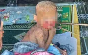 Bé trai vùng cao mang bệnh lạ tự lột da, chưa có tiền chữa trị