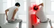 Bác sĩ cảnh báo rặn mạnh khi đại tiện dễ gây đột quỵ