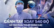 Bác sĩ Hà Nội dùng robot cắt khối u ung thư trực tràng cho bệnh nhân 33 tuổi