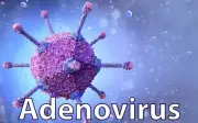 Bệnh đau mắt đỏ không chỉ do virus Adeno, Bộ Y tế khuyến cáo 7 biện pháp phòng