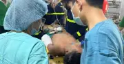Cưa phần tay để giải cứu nạn nhân 17 tuổi mắc kẹt trong máy cơ khí ở Huế
