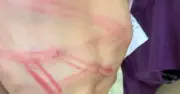 Cha dùng ống nhựa đánh con 9 tuổi nhập viện ở Quảng Trị